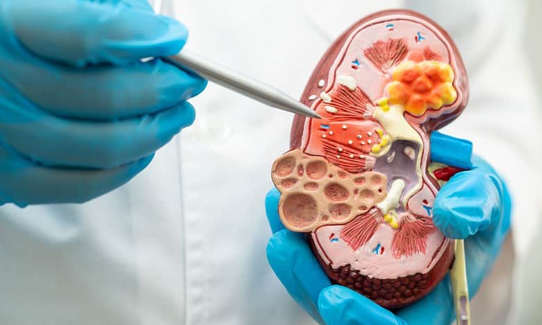 7 more arrested in Hyderabad kidney transplant racket case