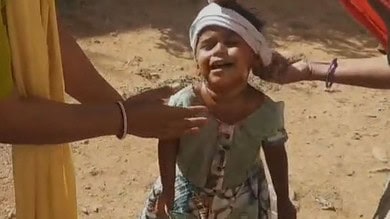 Stray dog attacks toddler in Nirmal town on Tuesday.