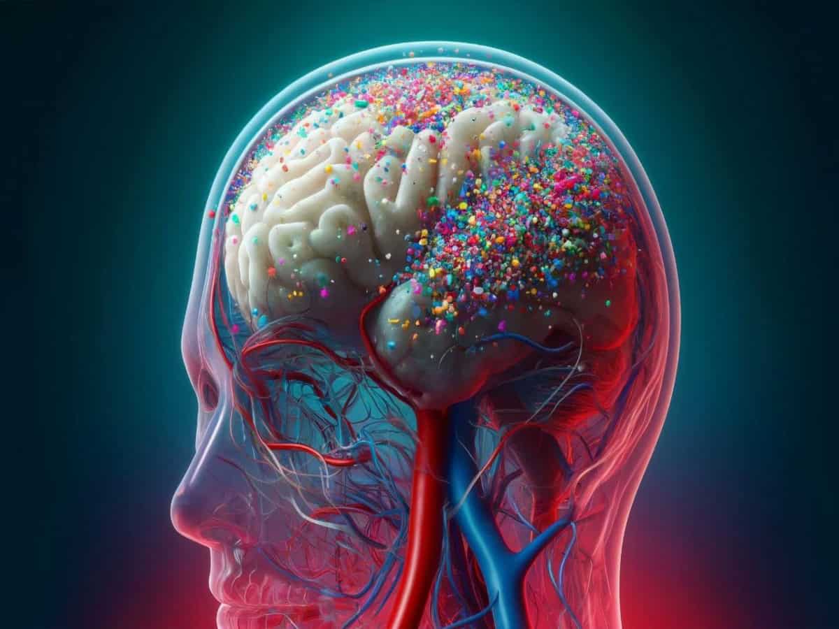 A brain of a person affected with Parkinson's disease