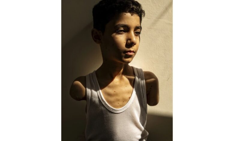 Portrait of young Palestinian boy Mahmoud Ajjour, who lost both arms in an Israeli airstrike in Gaza, captured in soft natural light wearing a white vest, looking solemnly into the distance. Photo by Samar Abu Elouf, winner of World Press Photo of the Year.