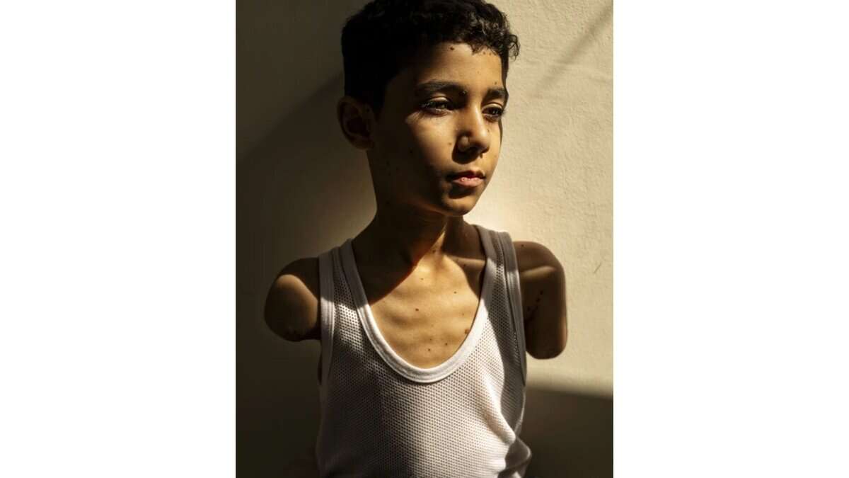 Portrait of young Palestinian boy Mahmoud Ajjour, who lost both arms in an Israeli airstrike in Gaza, captured in soft natural light wearing a white vest, looking solemnly into the distance. Photo by Samar Abu Elouf, winner of World Press Photo of the Year.