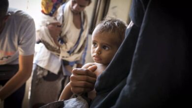A malnourished child receives medical treatment at an Action Against Hunger health clinic in Yemen, highlighting the ongoing humanitarian crisis and child malnutrition in the region.