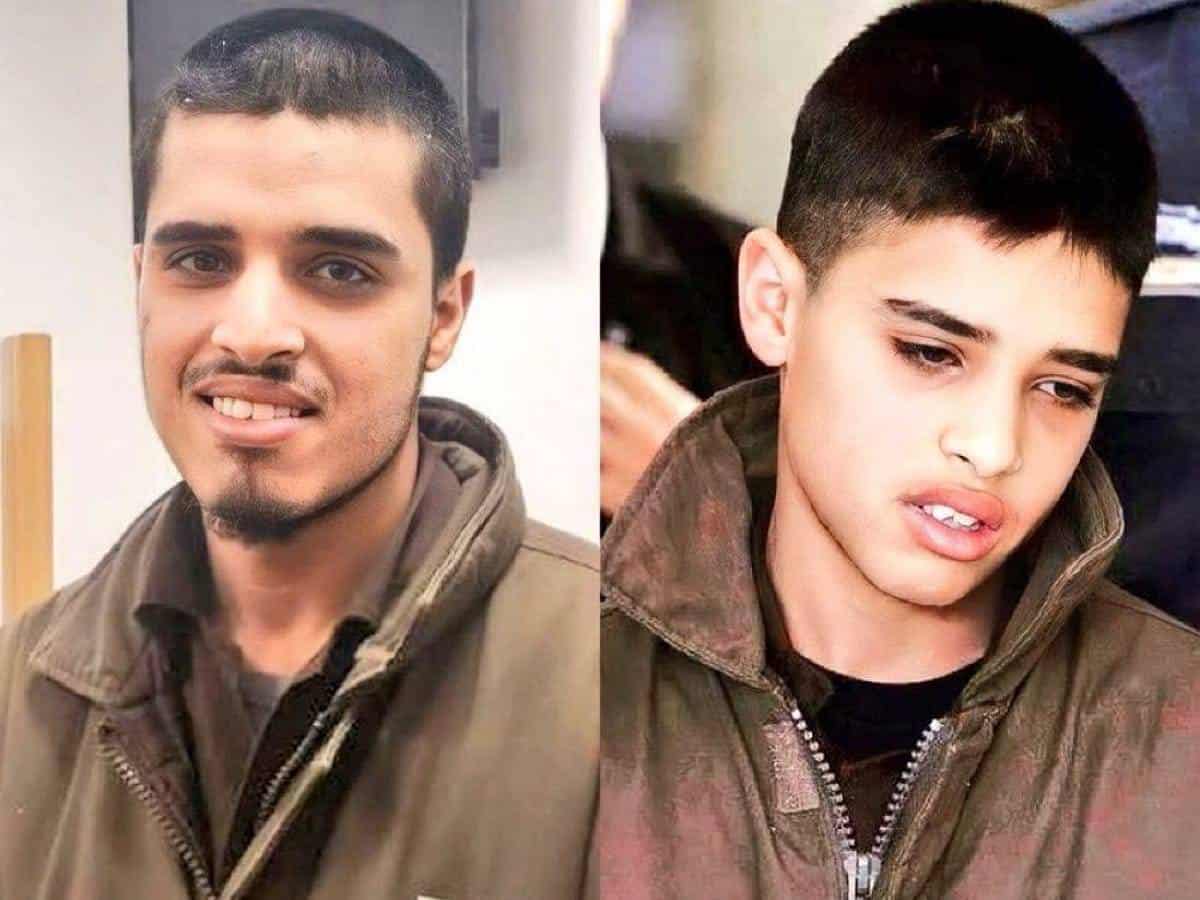 Side-by-side image of Ahmed Manasra — left shows him after release in 2025, smiling with short hair and a trimmed beard; right shows him in 2015 at age 13, looking distressed, wearing a similar jacket.