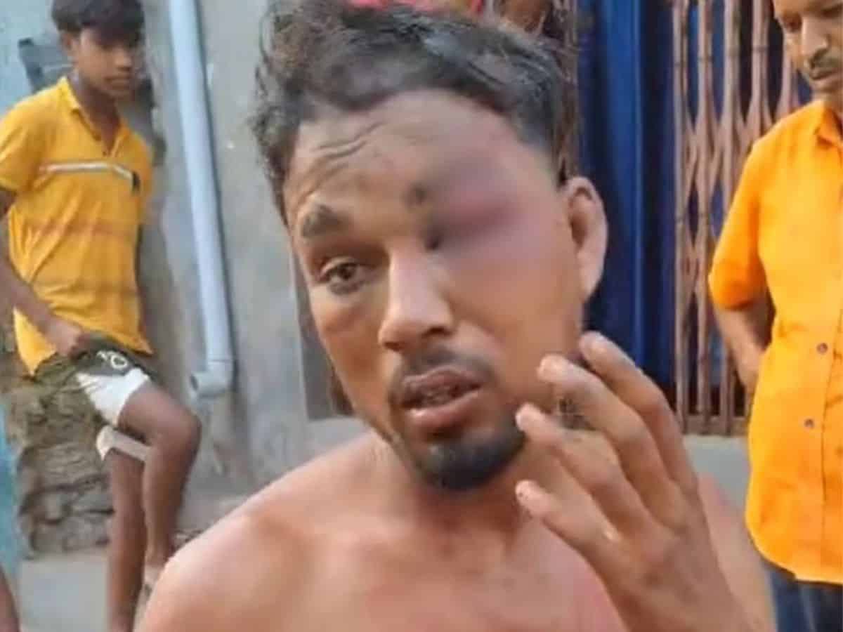 The image shows a young man beaten up in Chhattisgarh . April 13, 2025