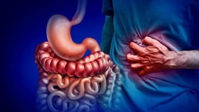 A representationa image depicting Inflammatory Bowel Disease