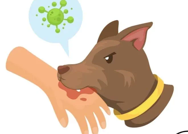Representational image of a dog biting a person