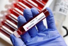 The image displays a picture of blood test and a label on which COVID-19 is written