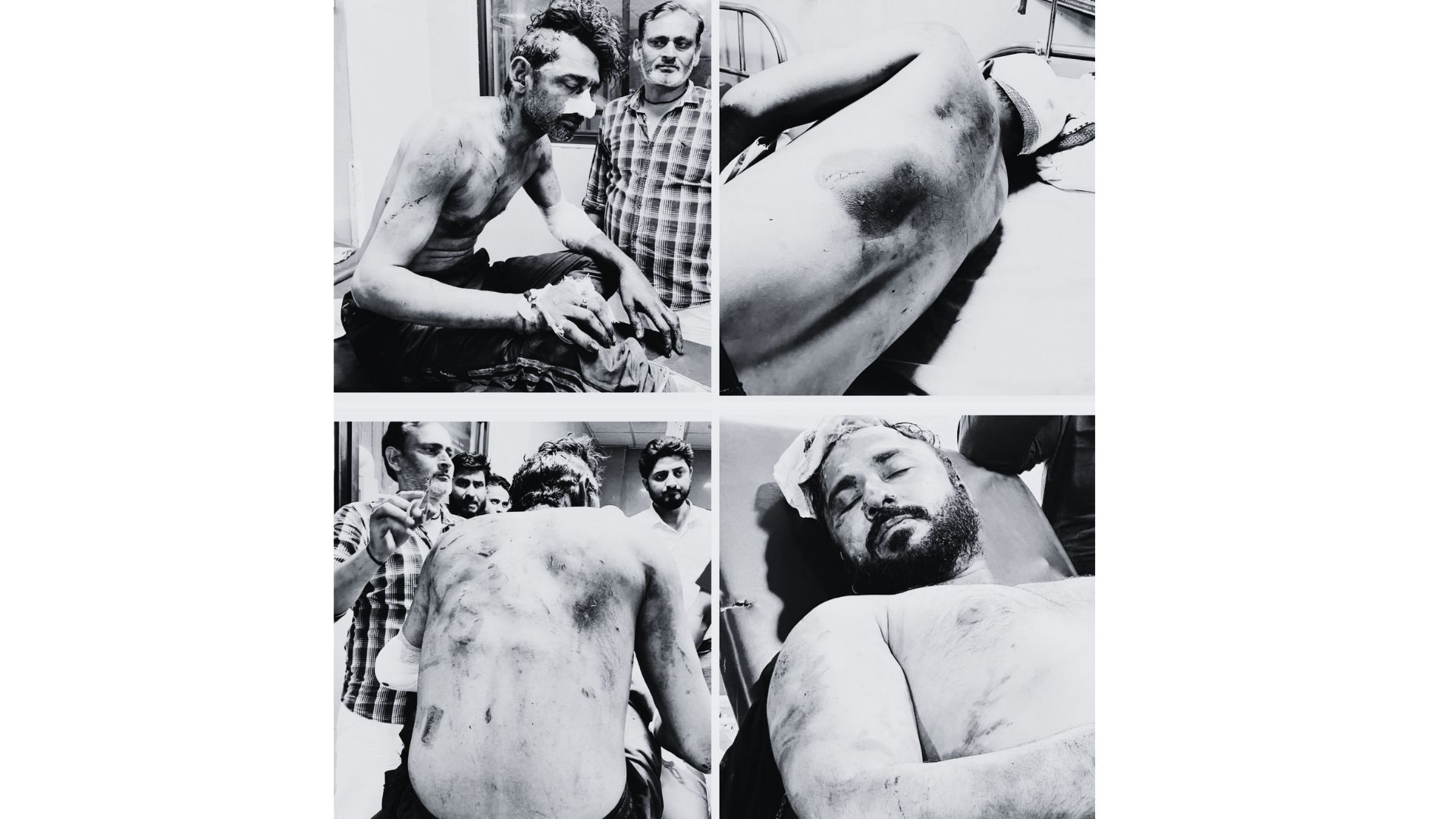 The image displays four grievously injured Muslim men attacked by a Hindutva gang in Aligarh