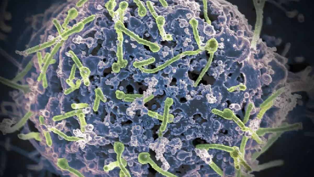 measles