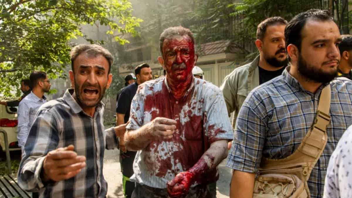 An injured man is helped at the scene of an explosion in downtown Tehran [Majid Khahi/ISNA via AP]