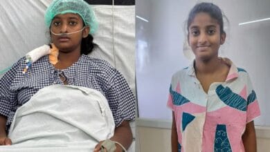 17 year old gets liver Transplant at OGH under Jeevandan's Super Urgent category