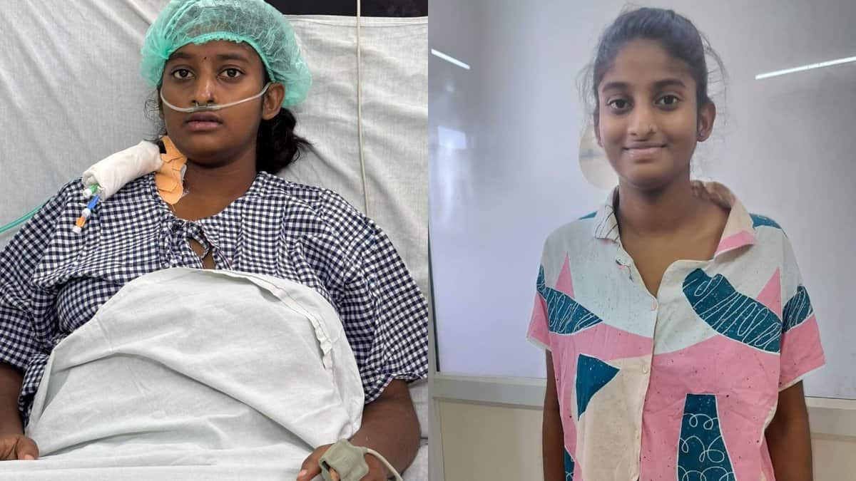 17 year old gets liver Transplant at OGH under Jeevandan's Super Urgent category