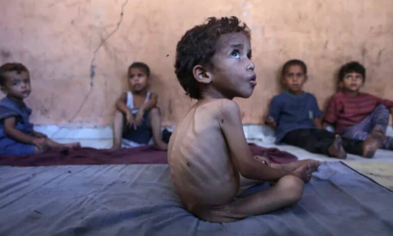 A severely malnourished Palestinian boy sits with his siblings inside their damaged home in Gaza’s Shati refugee camp.
