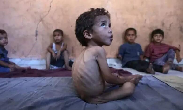 Malnourished children in Gaza