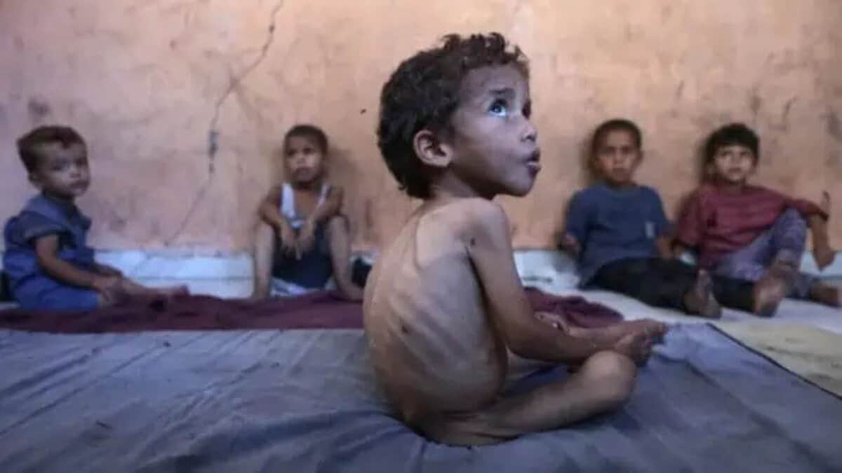 Malnourished children in Gaza
