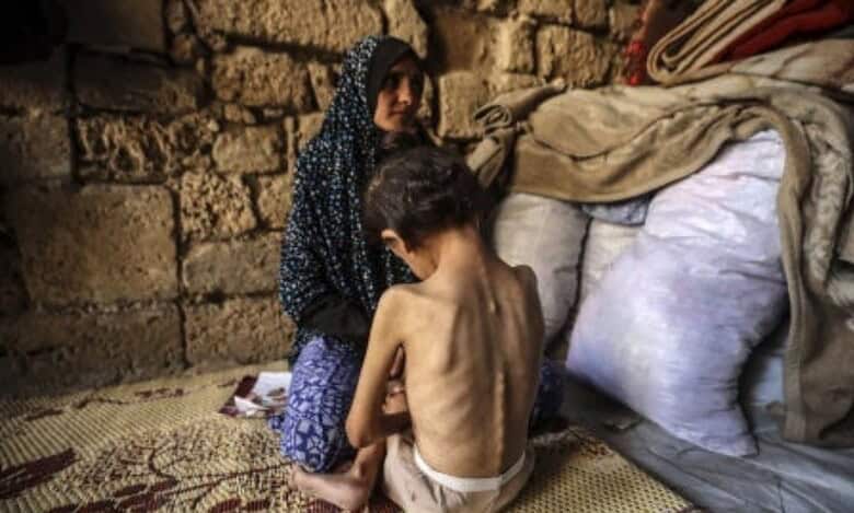 Woman consoles her malnourished six-year-old daughter at a shelter in central Gaza City