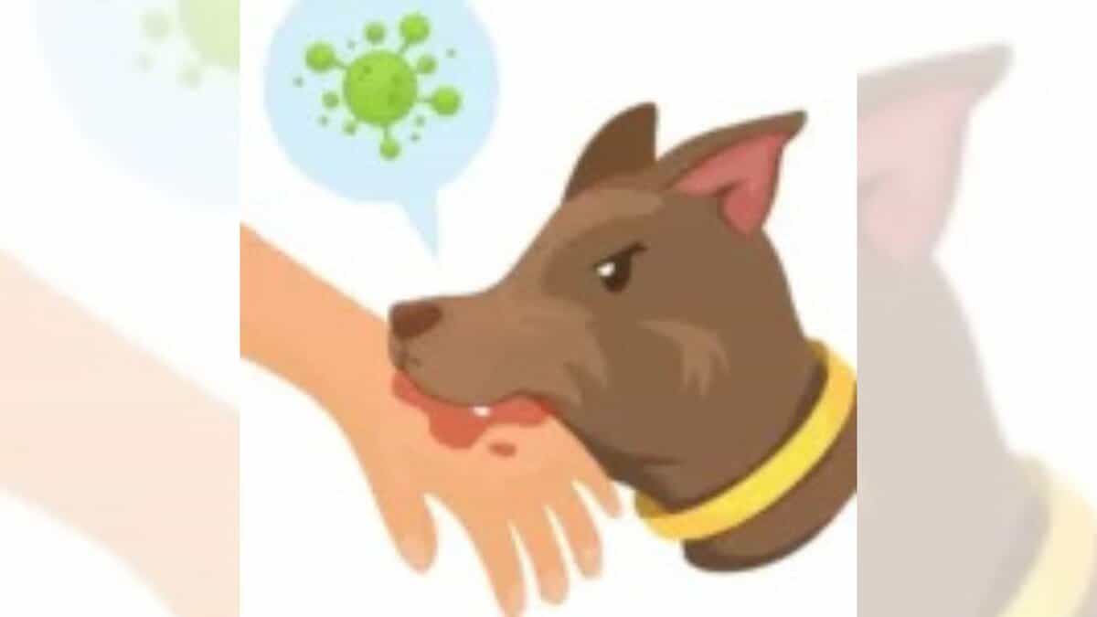 Representational image of a dog bite