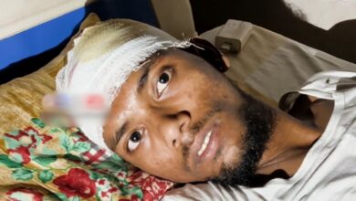 A grievously injured Mohammed Ibrahim