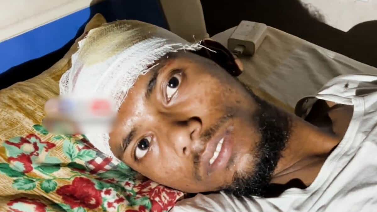 A grievously injured Mohammed Ibrahim