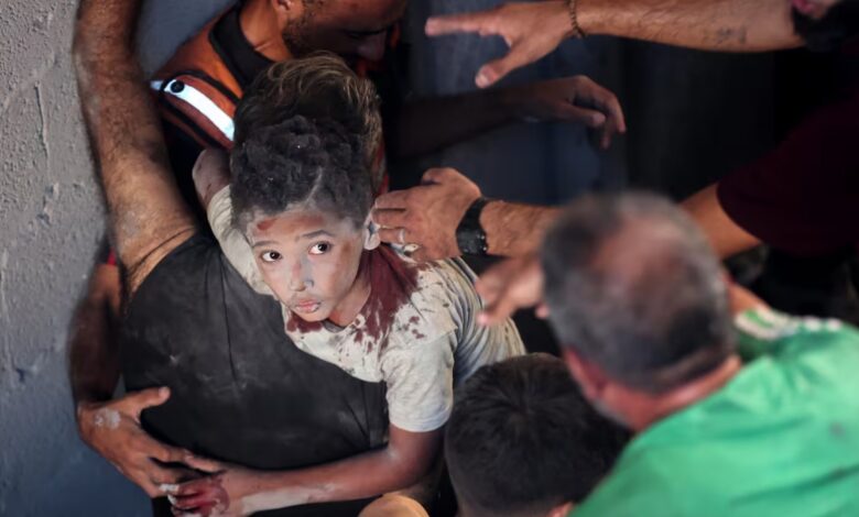 Injured Palestinian child covered in dust and blood is carried by rescuers after an Israeli airstrike hit buildings in the Al-Rimal neighbourhood of Gaza City, August 30.