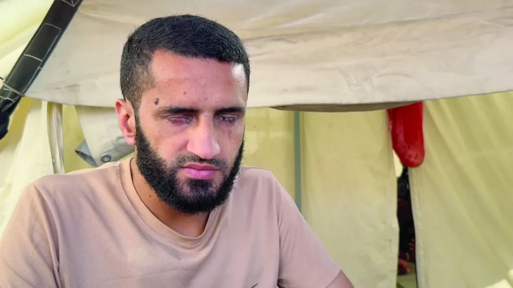 A man with closed, damaged-looking eyes sits in front of a light-coloured tent, appearing injured and unwell.