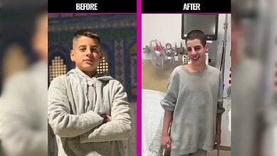 Side-by-side images of Mohammed Zaher Ibrahim: on the left, a healthy teenage boy standing with folded arms; on the right, the same boy after release from Israeli detention, visibly thinner with a shaved head, standing in a hospital room.