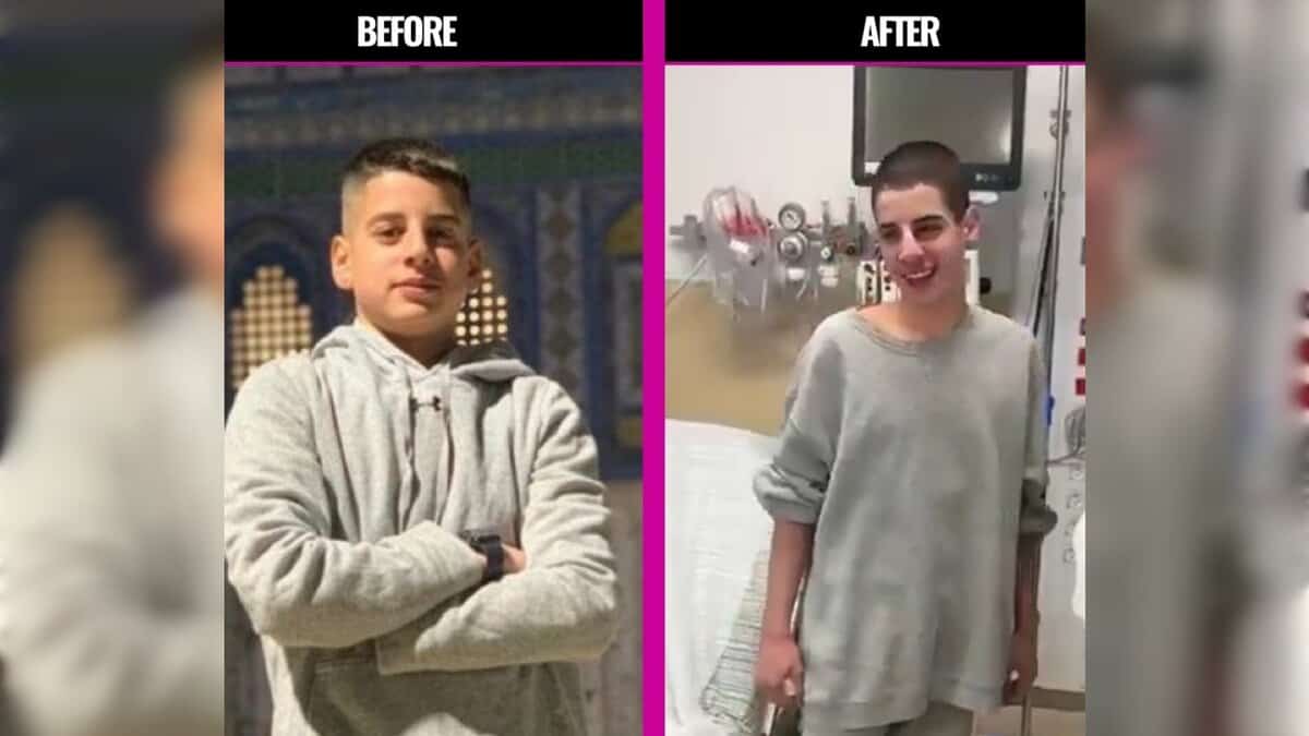 Side-by-side images of Mohammed Zaher Ibrahim: on the left, a healthy teenage boy standing with folded arms; on the right, the same boy after release from Israeli detention, visibly thinner with a shaved head, standing in a hospital room.