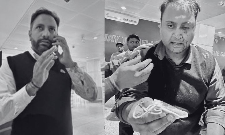 Air India pilot assaults passenger at Delhi airport, leaves him bloodied