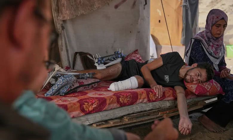 Yassin Marouf, 23, who lost his left foot and suffered a severe injury to his right leg after being hit by Israeli shelling in May, lies in a tent surrounded by his family in Zawaida, central Gaza (Abdel Kareem Hana/AP)
