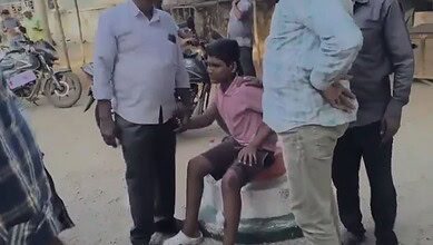 A boy is consoled after being bitten by a dog