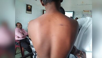 Image shows a wound on a student's back