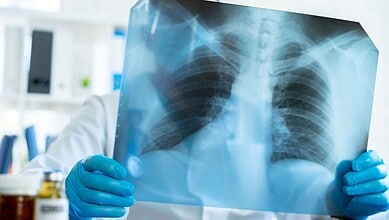 Doctor examining lungs x-ray scan in his office in hospital