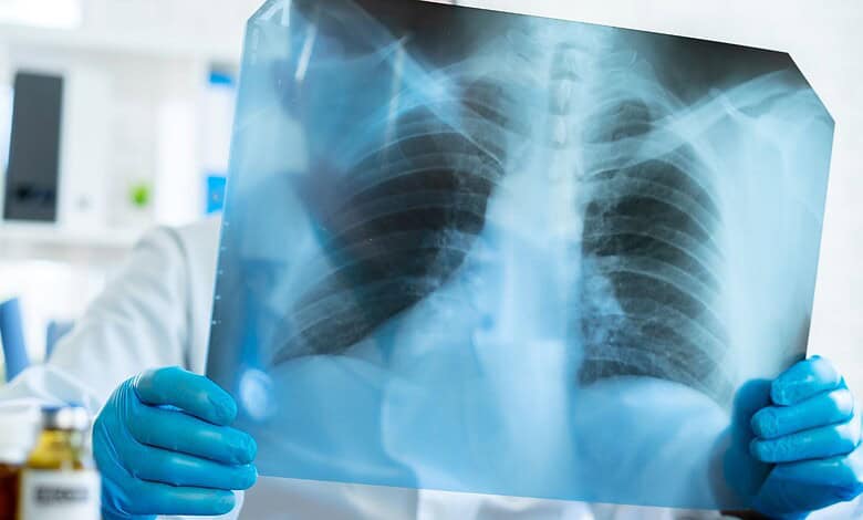 Doctor examining lungs x-ray scan in his office in hospital