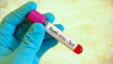 nipah virus
