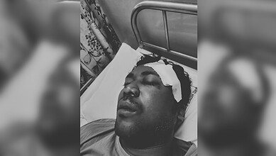 Zomato delivery worker critical after accident in Hyderabad