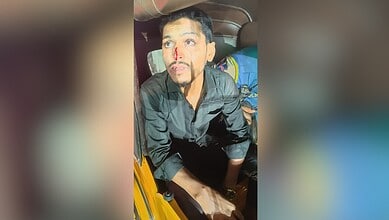 Injured man with blood on face after assault in Hyderabad's Troop Bazaar area. Tension reported following.