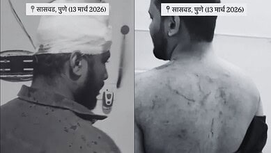 Man attacked during Iftar at Pune tourist location, causing injuries; police register 150 cases.