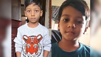 Young boy with serious expression, wearing a blue shirt, after battling a dog bite for 15 months.