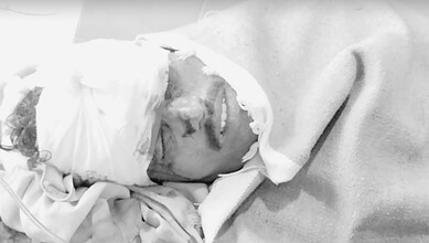 Injured individual with head bandage lying on hospital bed, receiving medical treatment.