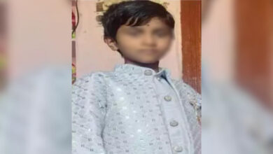 Minor dies fifteen days after being attacked by stray dogs