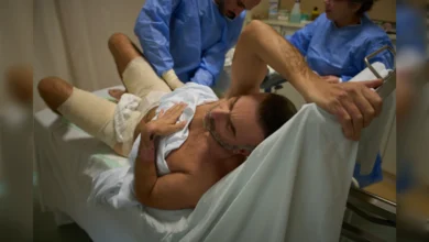 A burn-injured man receives treatment from doctors at a hospital in Sidon after an airstrike.