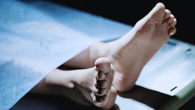 Body of a 13-year-old boy lying on a hospital bed, highlighting a tragic incident.