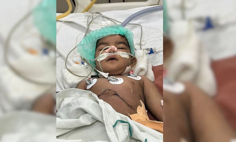 Infant patient after a rare liver transplant at Osmania General Hospital, Hyderabad.