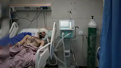 Patient on ventilator with medical equipment in hospital ICU setting.