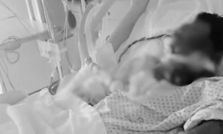 Patient on ventilator in hospital ICU with medical staff attending.
