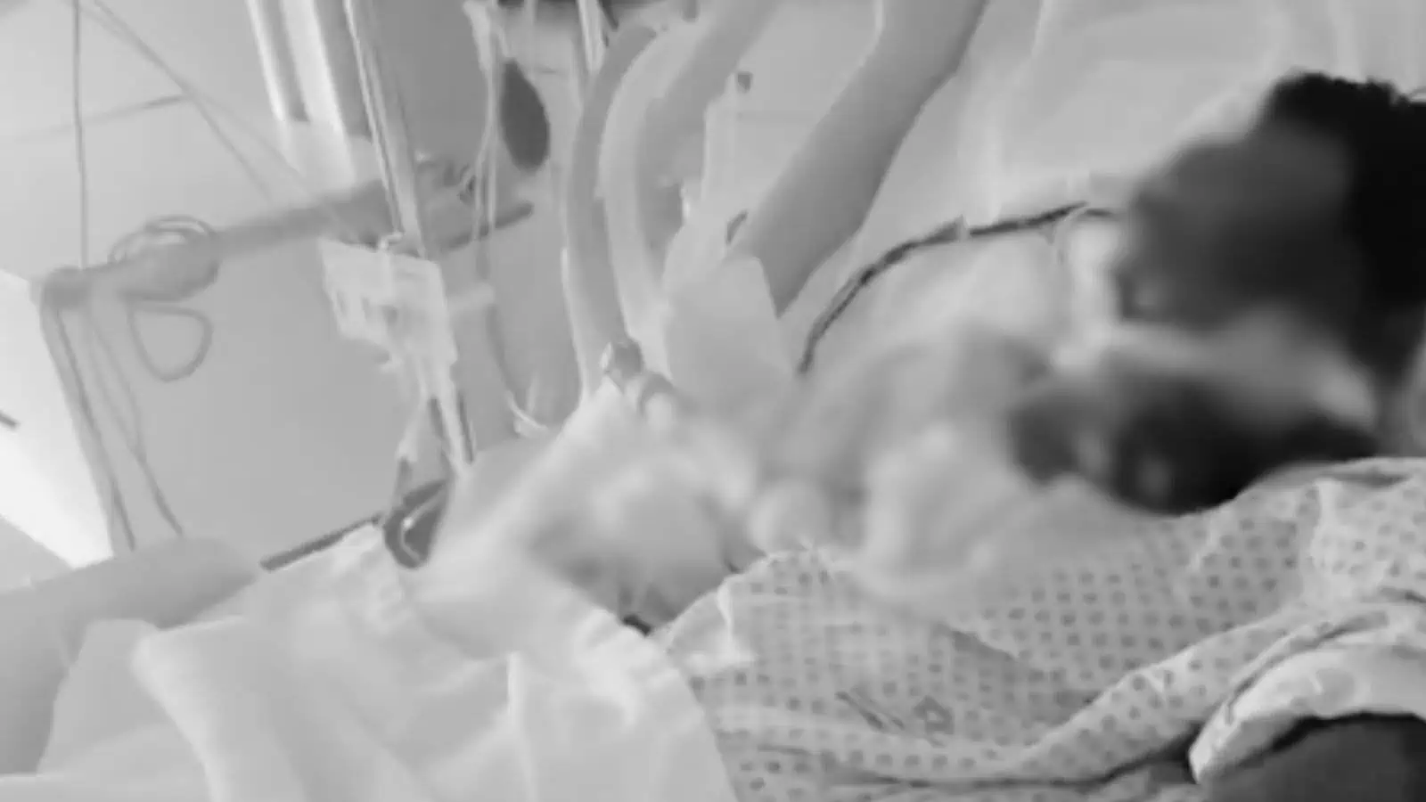 Patient on ventilator in hospital ICU with medical staff attending.