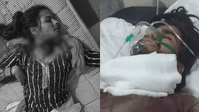 Injured woman lying on hospital bed with oxygen mask after alleged honour killing incident.