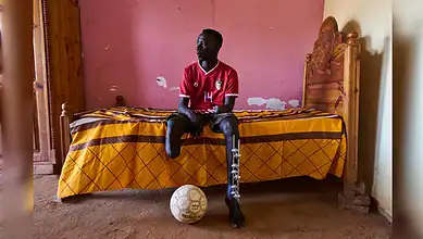 Young man with prosthetic leg sitting on a bed in a simple room with a soccer ball nearby.