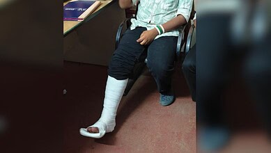 Protester with leg injury sitting in Bengaluru during NEET protest, AISA blames ABVP.