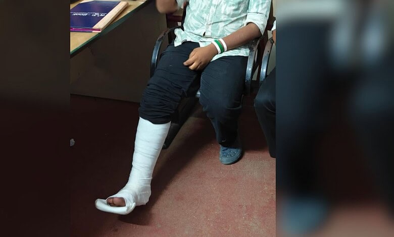 Protester with leg injury sitting in Bengaluru during NEET protest, AISA blames ABVP.
